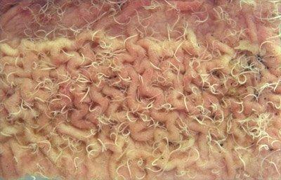 d) Trichuris suis - the whipworm - residing in the colon (large intestine) and producing colitis in growing pigs that can be