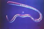 2- INTESTINAL ROUND WORMS (NEMATODES) Ascaris lmubricods (common round worm) Enterobius vermicularis (pin worm) Trichuris trichuria ( whip