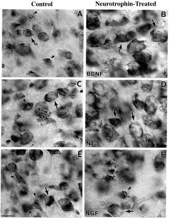 472 BOTTJER & ARNOLD Figure 3 Left panels show apoptotic cells in RA induced by a lesion of lman in 20-day-old male zebra finches.