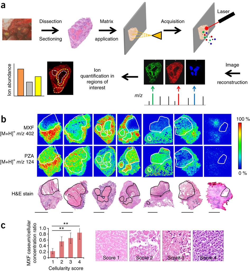 (a) MALDI mass spectrometry imaging of small molecules in TB-infected lung tissue.