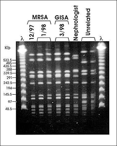 Typing of MRSA- PFGE Typing of strains PFGE with SmaI most frequently (except for ST398 which is not typable with PFGE with SmaI ) - very