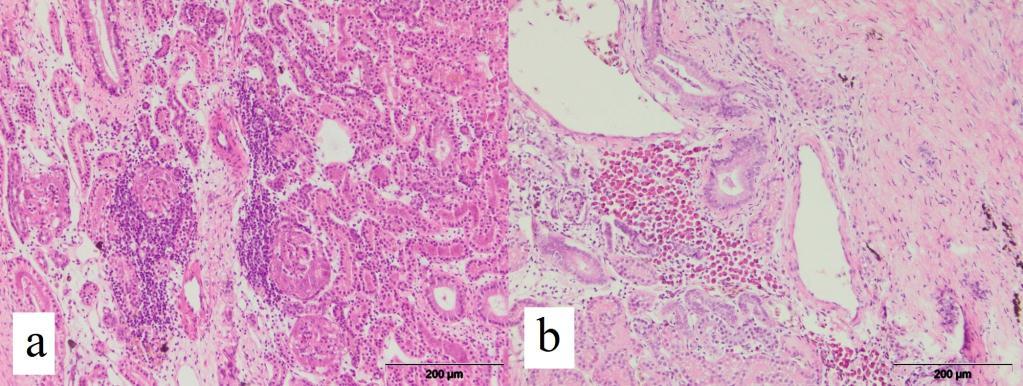 Histopatološke promene u bubrezima U bubrezima kod 14/30 (46,6%) kornjača zapaženi su morfološki znaci intersticijalnog nefritisa različitog intenziteta (slika 38a),
