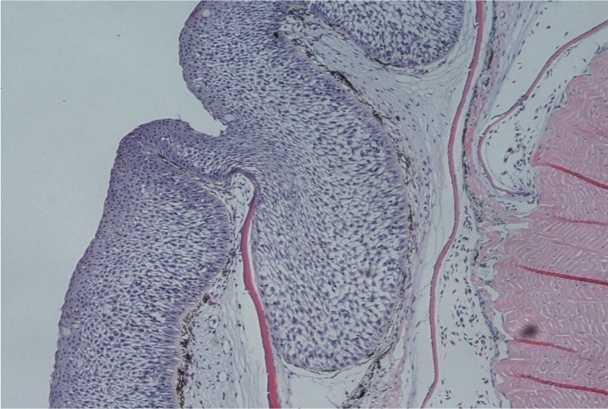 Figure 4 Histopathological features of PSD. Transverse section of skin showing progressive dermal hyperplasia of the epithelium with spongioform appearance. 4.2.