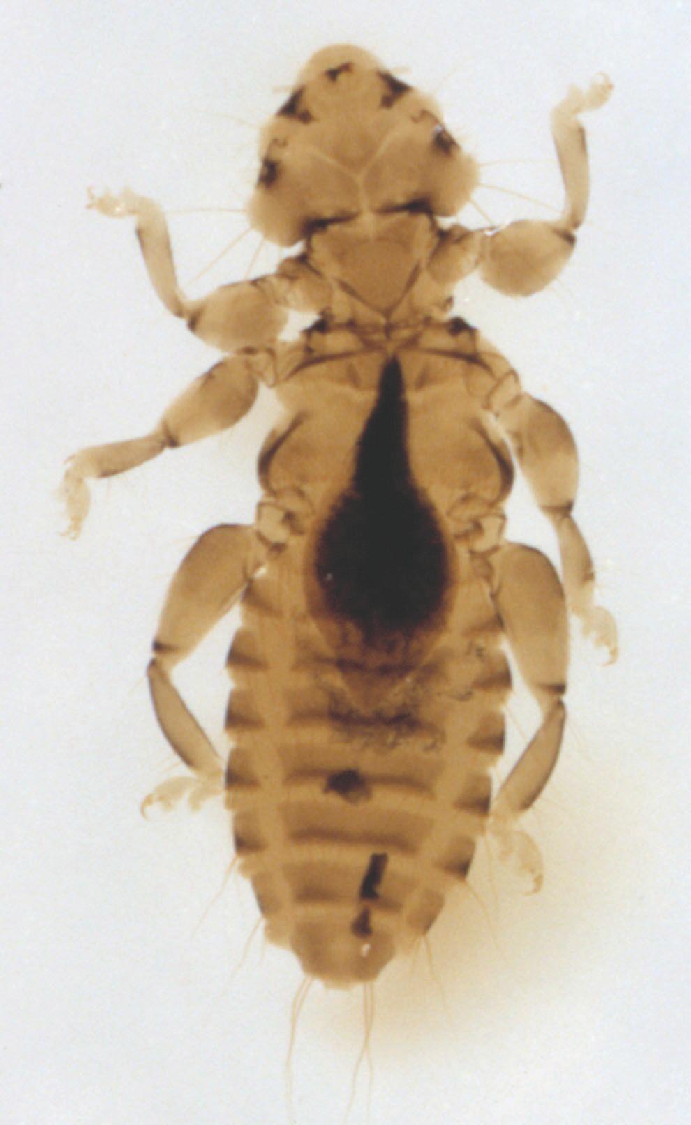 Chicken Head Louse The chicken head louse constantly nibbles at the skin scales (Figure 3) and is a serious pest of young chickens and turkeys. It is frequently found on the head and neck of poultry.
