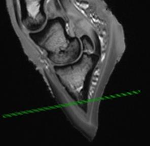 bone Deep digital flexor tendon MRI Analysis
