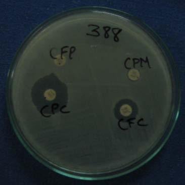 Three Dimensional Extract Test A total of 47 Cefoxitin resistant isolates were tested, among that 20 (43%) isolates