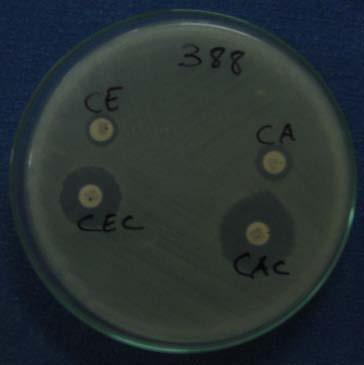 Escherichia coli and 15% (3/20) Pseudomonas sp. (Table 2).