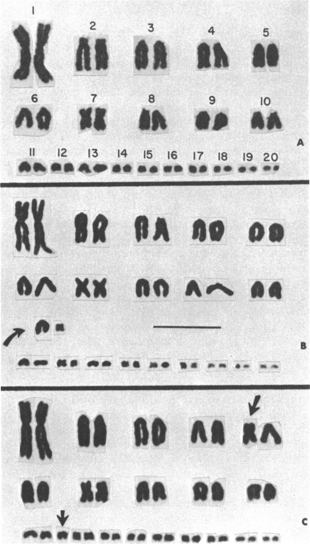 6" 2 ~ ~~~3 ~ 4 5 6 7 8 9 10 1 12 1 3 14 15 16 17 18 19 20 A bs 4* 00 1*...e. * me oa^ s. f.. o o o 0 _ FIG. 4. Chromosomes of three specimens of Sceloporus melanorhinus. A. Karyotype KA (2n = 40), described on pages 14-16; U.