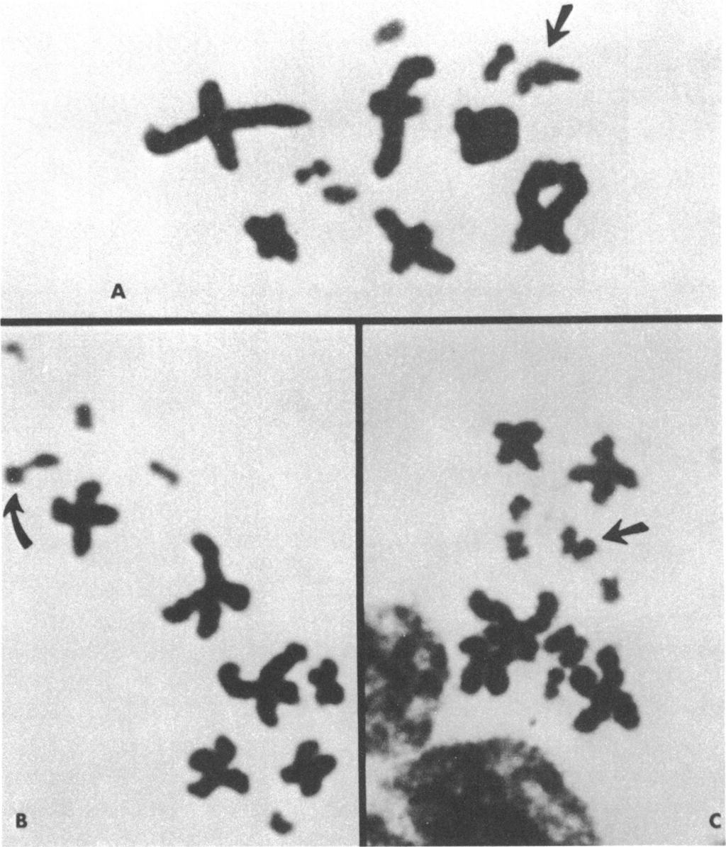 20 AMERICAN MUSEUM NOVITATES NO. 243 1 A S B FIG. 7. Spermatocytes of Sceloporus lundelli. A. Primary spermatocyte (metaphase I), with six bivalents of macrochromosomes + five bivalents of smaller ones (n = 11).