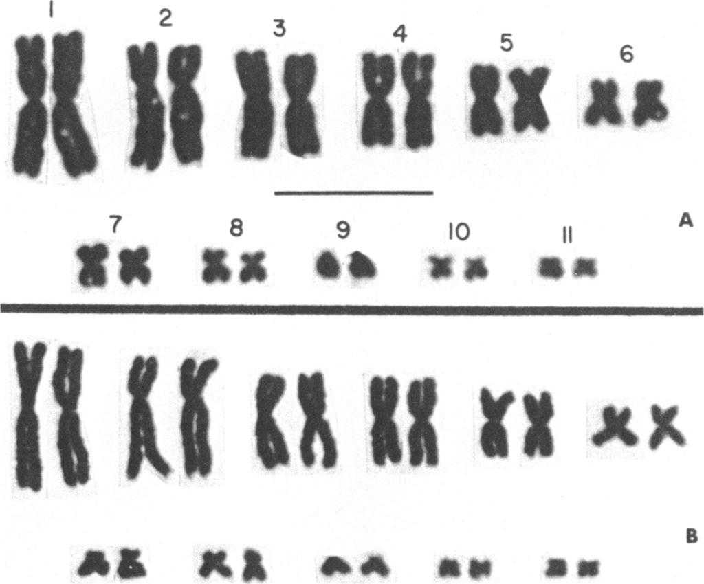 1970 COLE: LIZARD KARYOTYPES 25 12 I6~~~~~~~~~~~~ 7 8 9 A0 11 A& AA a" an FIG. 10. Karyotypes of Sceloporus spinosus (2n = 22). A. Individual with pair number 7 metacentric; U.A.Z. No.