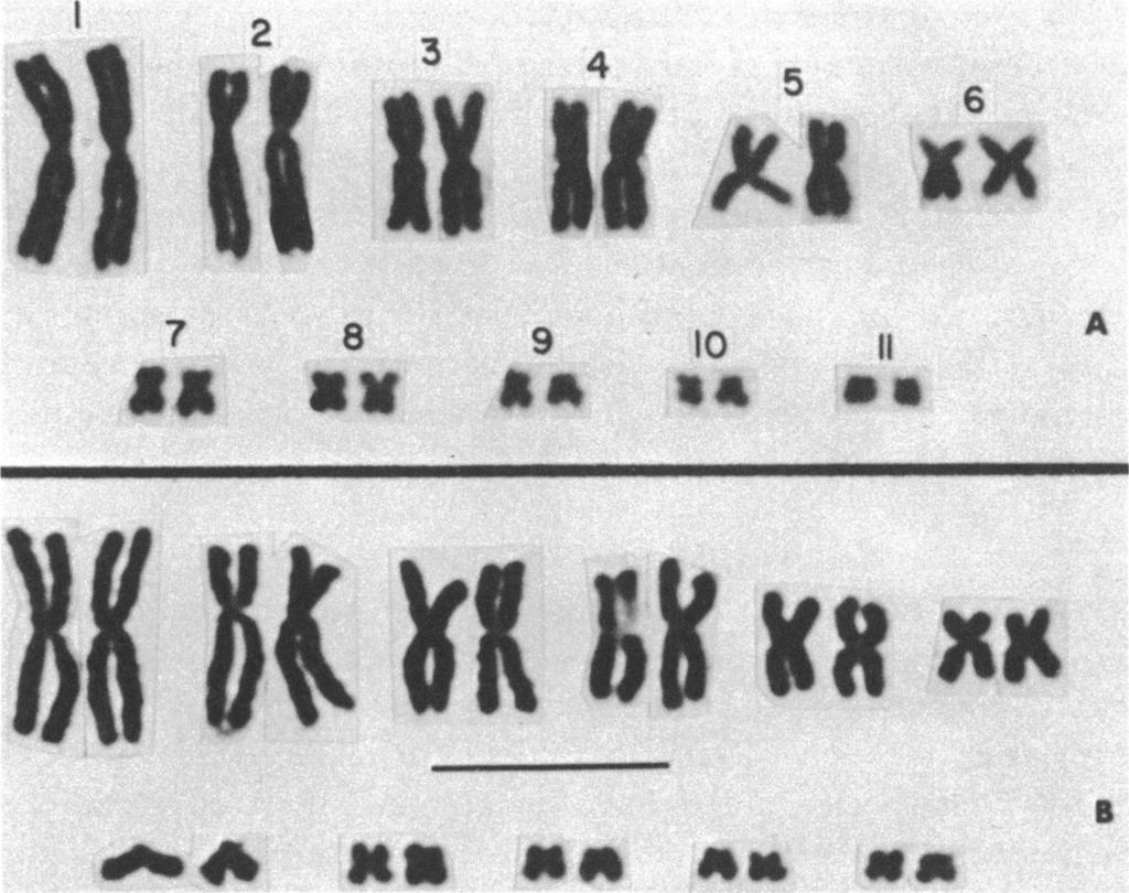 1970 COLE: LIZARD KARYOTYPES 27 12 7 8 9 10 A 55(1MVWL 1;a.. FIG. 11. Karyotypes of Sceloporus horridus (2n = 22). A. Individual with pair number 7 metacentric; U.A.Z. No.
