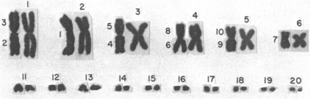 Composite mock-up "karyotype" representing that of spinosus group lizards from hypothetical population ancestral to both the orcutti subgroup and lundelli subgroup (see fig. 16).