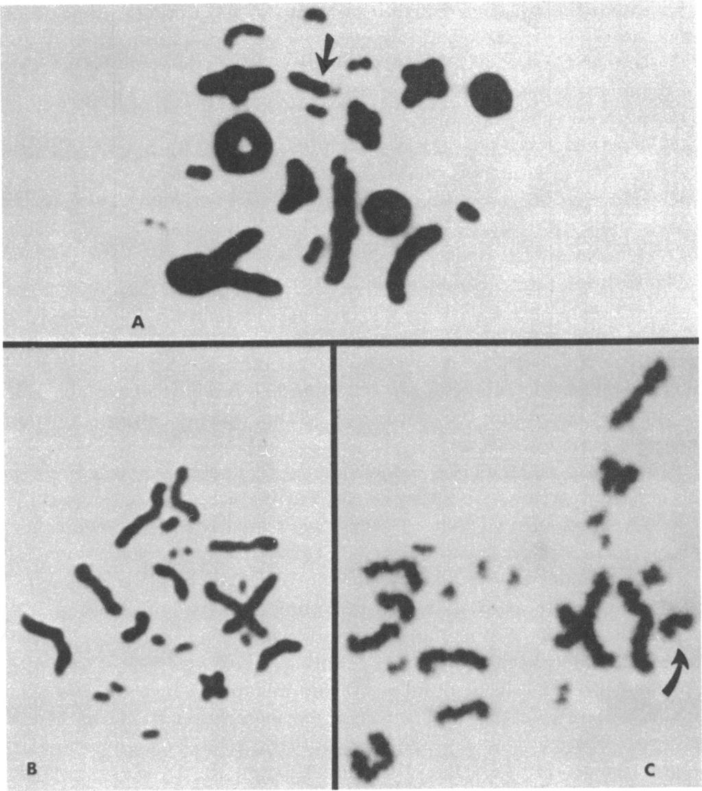 6 AMERICAN MUSEUM NOVITATES NO. 2431 ob A / "a a0 p _ t S40 p B C FIG. 2. Spermatocytes from an individual of Sceloporus clarki with atypical 20 + 1 + 19 karyotype (KB); all cells from U.A.Z. No.