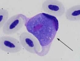 Diagnosis P Blood Smear Observation of gametocytes in stained thin blood smears P Histopathology Identification of schizonts in tissue P History & clinical signs P