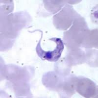 Trypanosomiasis Section Stercoraria P Develop in the posterior