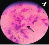 Figure 1: The cytological features of the proestrus phase are characterized by intermediate cells and