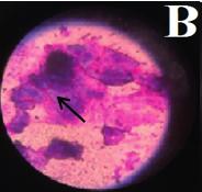 Figure 2: The cytological features of the proestrus phase are characterized by superficial cell and