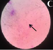 Figure 3: The cytological features of the proestrus phase are characterized by basal cells and parabasal cells.