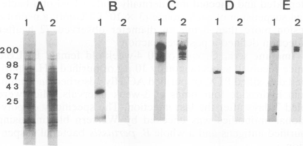 bronchiseptica (lane 2) bacterial suspension was submitted to SDS-8 to 25% PAGE, and proteins were stained with Coomassie blue (A) or were transferred to Hybond C-Super membranes after