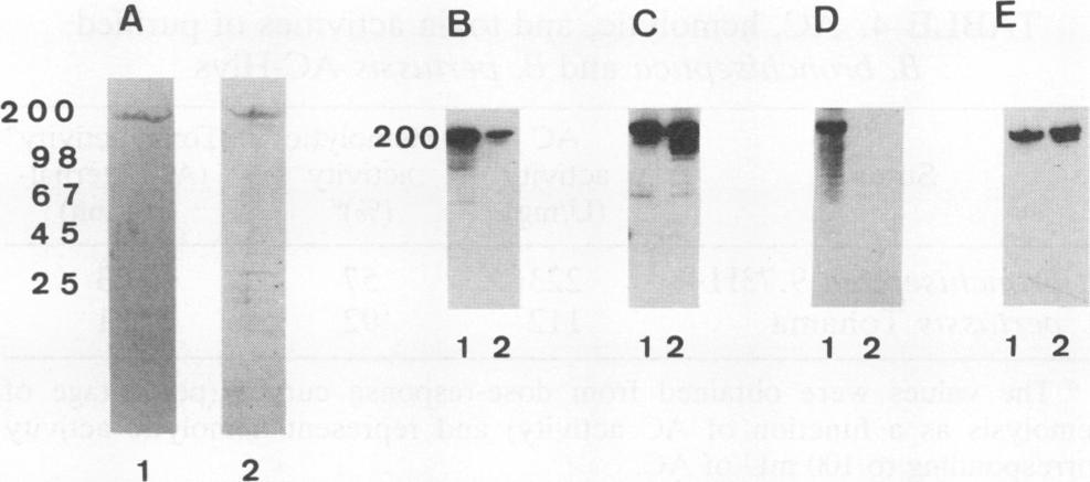 bronchiseptica AC-My (lane 2) was submitted 1 2 3 4 5 to SDS-8 to 25% PAGE, and proteins were stained with Coomassie blue (A) or transferred to Hybond C-Super membranes and incu- Days after challenge