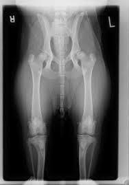 X-ray of a 10-month old