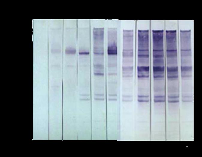 75.5, 67, 32.4, and 28 kda antigens of T. evansi revealed by sera of rabbits experimentally infected with an Indonesian stock of the parasite (UCHE; JONES; BOID, 1993).