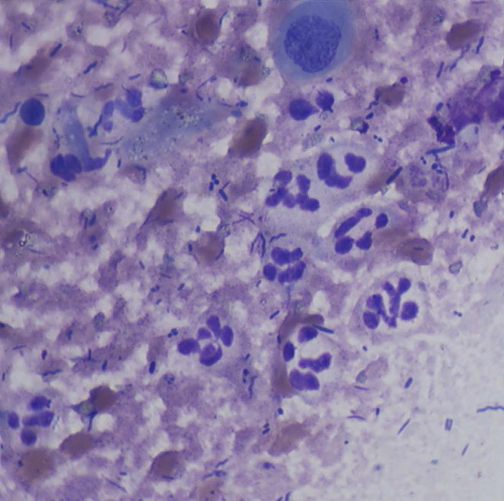 Fig 3. Leukocytes on Diff-Quik stained fecal cytology. ance of normal flora. Not all spores are Clostridium perfringens (Fig. 5), and not all spiral bacteria are Campylobacter.