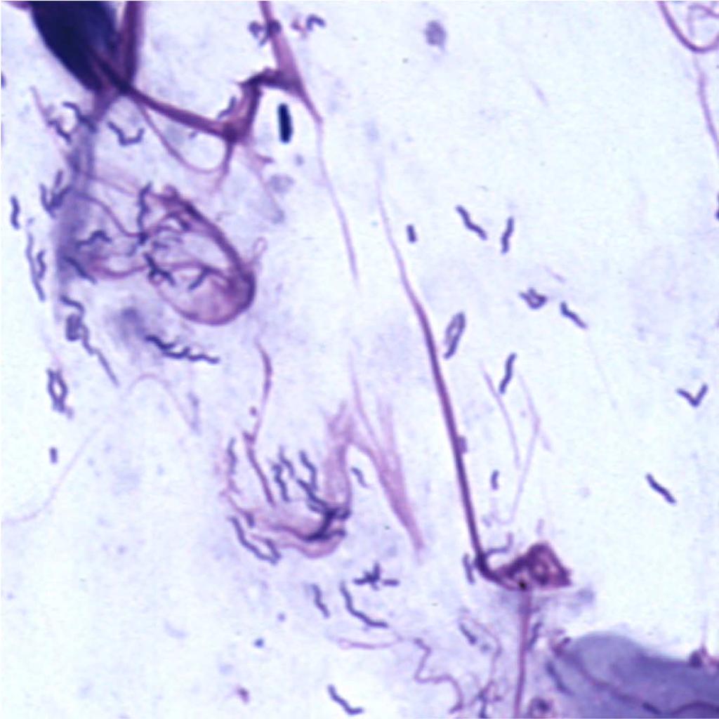 Fig 4. Campylobacter-like organisms on fecal cytology stained with Diff-Quik. 3. The slides should be air dried and then fixed for approximately 3 seconds in 70% to 100% methanol. 4. Save at least 1 slide at the practice to be reviewed when the results are reported.