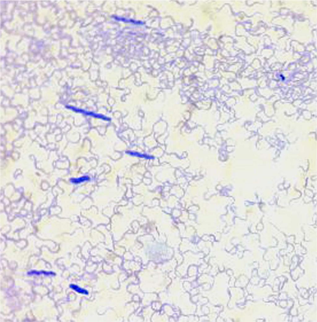 Fig 6. Serpulina-like spiral organisms throughout Diff-Quik stained fecal cytology. A few, darker staining treponeme-like organisms are also seen. (Provided by Dr. J. Michael Harter.