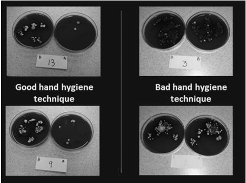 Targeted Infection Prevention (TIP) Study in 12 LTCFs: Hand Hygiene Educational Module Koo E et al.