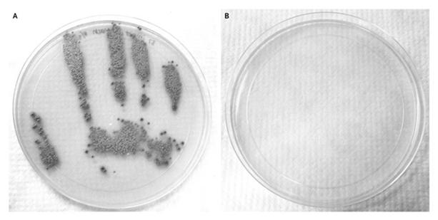Contamination of HCW Bare Hand After Touching Patient Colonized with MRSA Before Hand Hygiene Donskey CJ et al.