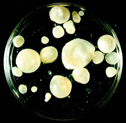 Petri dish filled with daughter cysts