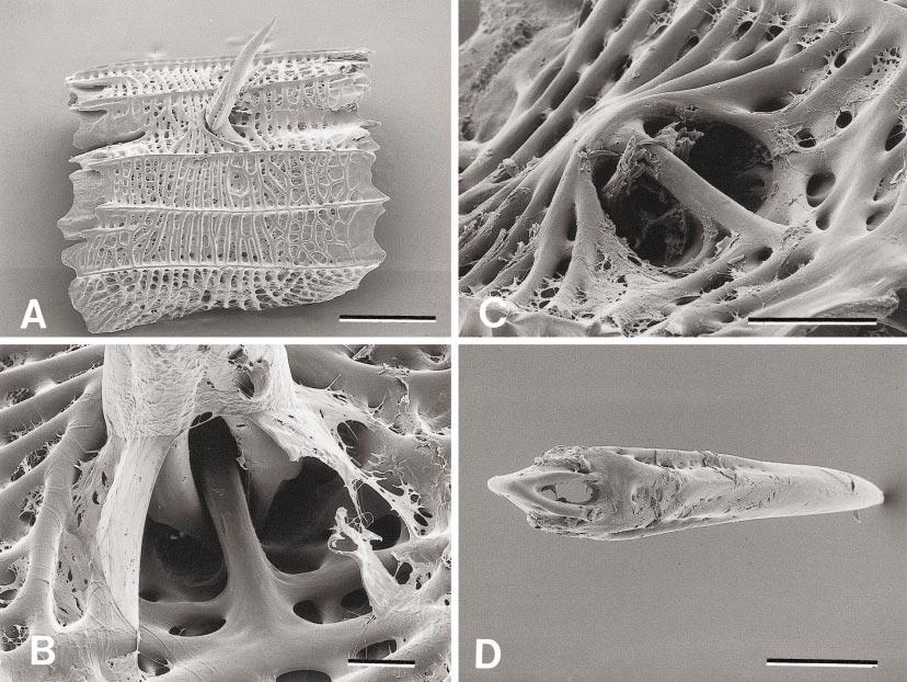 2002 BRITZ AND JOHNSON: SKELETAL ONTOGENY OF INDOSTOMUS 21 Fig. 13. Indostomus. SEMs of dorsal-fin spine articulation. A. I. paradoxus, 32 mm (USNM 366875), fin spine with dorsal plate of body armor in dorsolateral view.