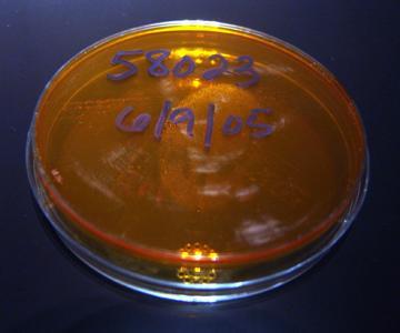 Dermatophyte Test Media Fungal culture media. Contains an indicator that turns the media gel from orange to red as the ph of the media changes.