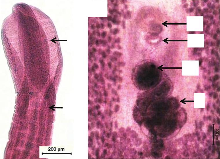 pore (Vp), uterine pore (Up) and Uterus (Ut) and width of 59.6 x 36.4 µm. Table 3 summarises the measurements of adult worms recovered from cats.