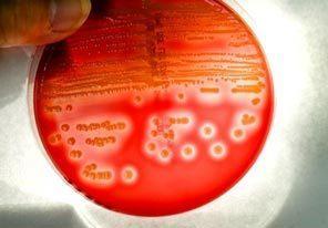 Methicillin Resistant Staphylococcus aureus MRSA