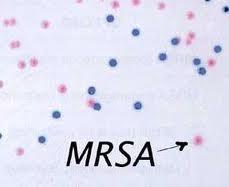 What is MRSA (Methicillin Resistant Staphylococcus
