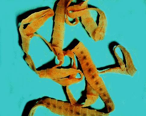 Diphyllobothrium latum Common Name: Fish Tapeworm Broad Tapeworm Morphology Adult worm is yellowish grey in colour.