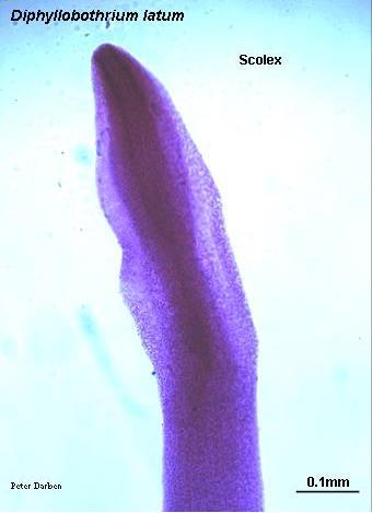 Diphyllobothrium latum Scolex is spoon-shaped or spatulate.