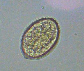 Diphyllobothrium latum Ova Passed out in the host s feces in large numbers. Contains abundant granules and unsegmented ovum.
