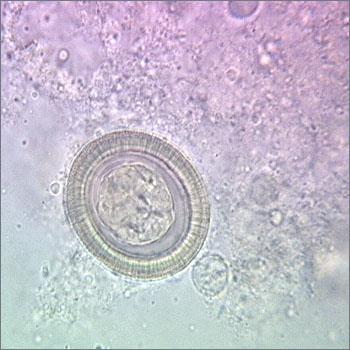 Echinococcus granulosus Ova Ovoid in shape Resemble Taenia ova Hexacanth embryo