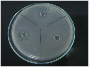 Control (MRS broth) (a) (b) : well of agar : clear zone Figure 4. Result of the highest antimicrobial activity by isolate 411 towards Escherichia coli (clear zone = 15.