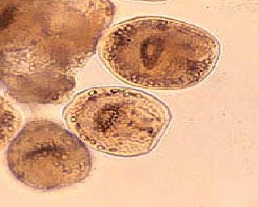 Echinococcus adult worms develop from protoscoleces and are typically 6mm or less in length and have a scolex, neck and typically three proglotids, one of which is immature, another of which is