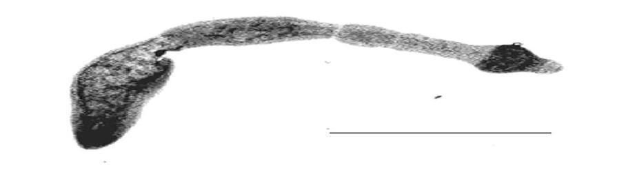 Figure 2: Larval stage of E. granulosus. Source: (Mandell et al., 2010). 2.3.3. The adult stage Figure 3: Adult E. granulosus. Source: (DPDx. CDC, 2009) 2.4.