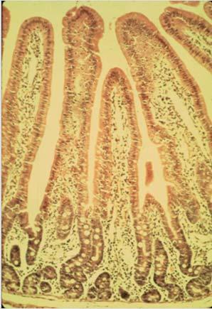 Microscopic cross-section of normal intestinal villi Cross-section of virusinfected villi (green) 43 44 Salmonella Diarrhea Calves can shed it in