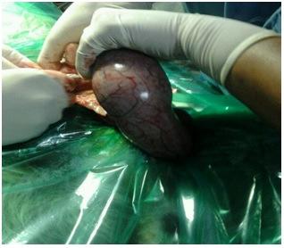 And Suresh Kumar, R.V. (2014). Successful Management of a Critical Case of Pyometra in a Bitch. A Case Report. Research Journal of Animal, Veterinary and Fishery Sciences,2(8): 21-23. [11] Okano, S.
