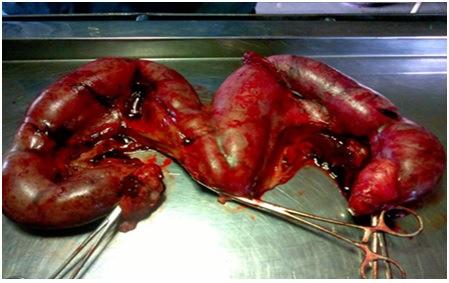 Pyometra and its Complication in Bitches- A Case