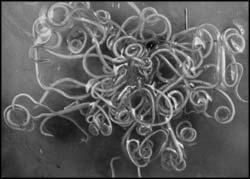 Roundworms Segmented http://www.wormawareness.