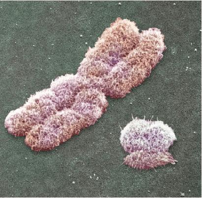 Males Men normally have an X and a Y combination of sex chromosomes.