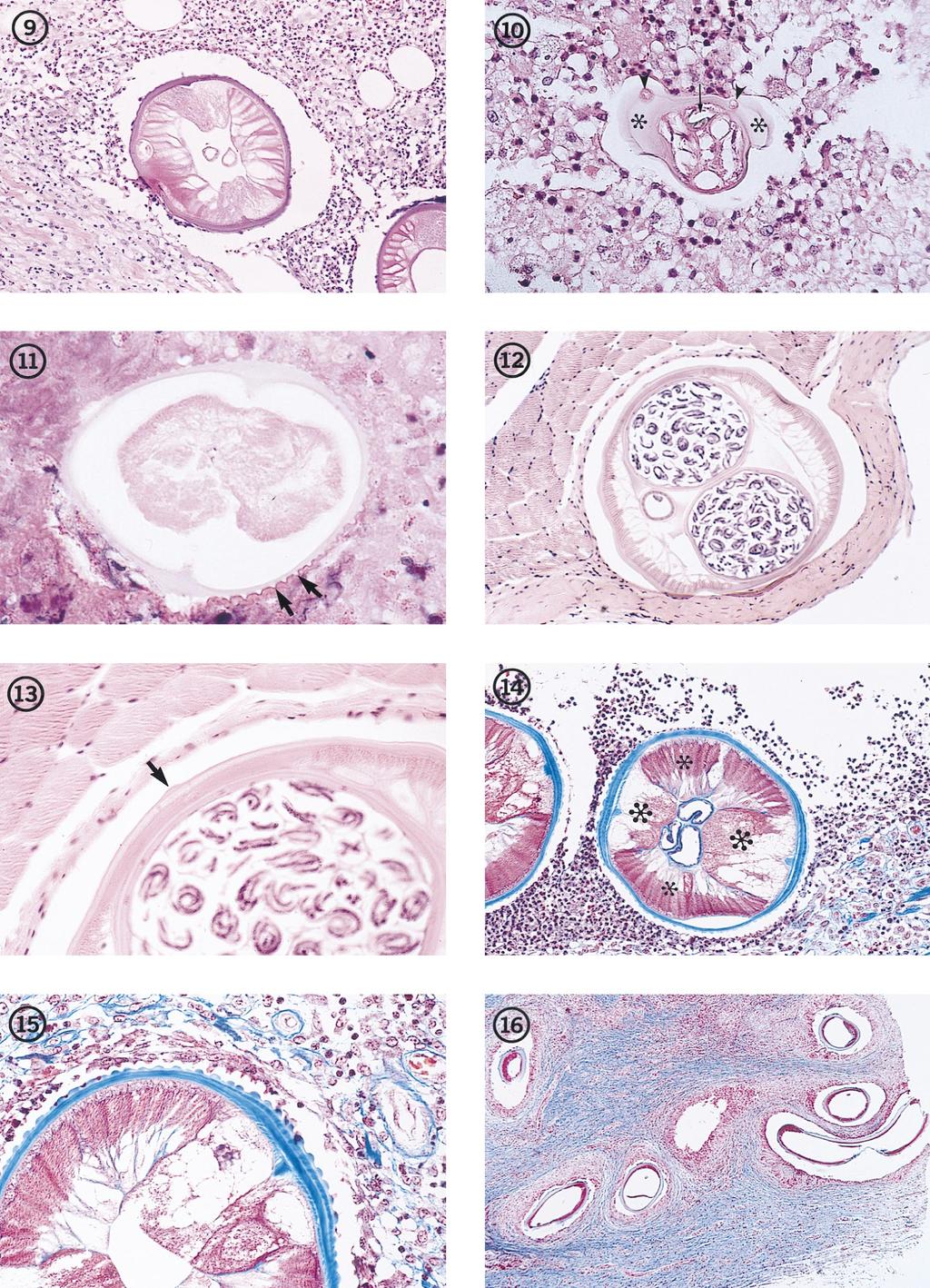 370 ORIHEL AND EBERHARD CLIN. MICROBIOL. REV. FIG. 9. Transverse section through a dead, degenerating male D. tenuis worm in human subcutaneous tissues.